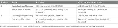 Respiratory involvement and sleep-related disorders in CMT1A: case report and review of the literature